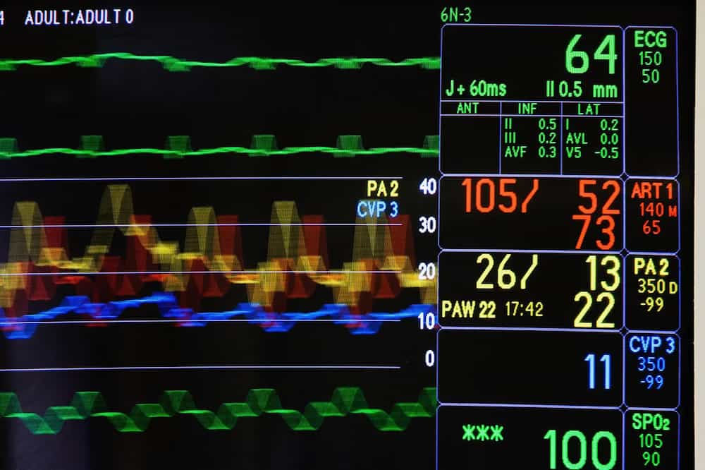 Screen image of a vital signs monitor