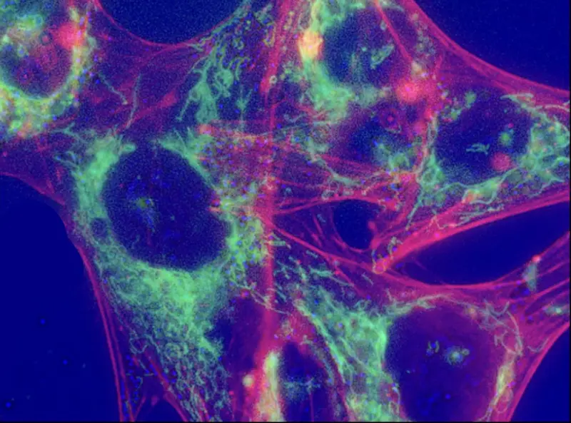 Measuring mitochondrial networks and F-Actin in endometrial cancer cells