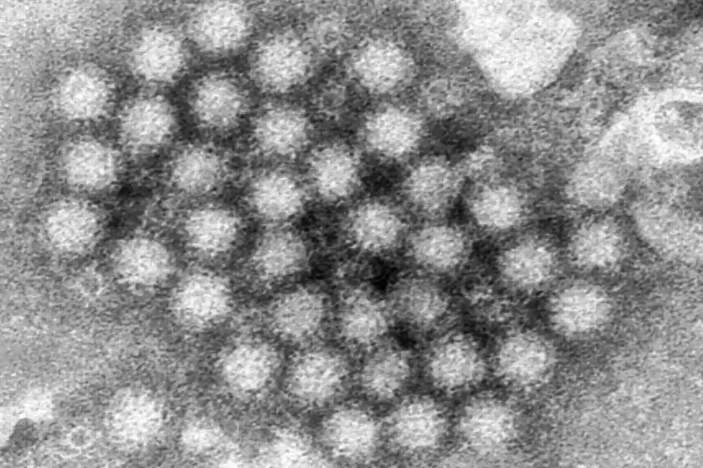 Norovirus, also known as the stomach bug, is on the rise and has surpassed cases in previous seasons. Image shows a cluster of norovirus virions. Photo by Charles D. Humphrey/CDC via AP