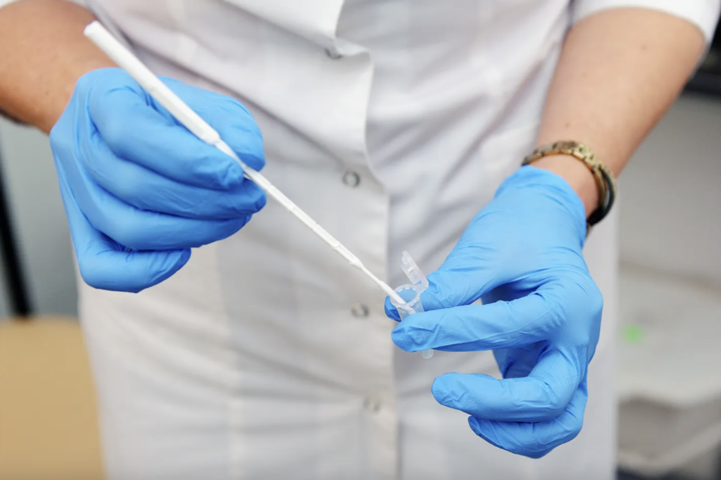 Photo of doctor holding pap smear test