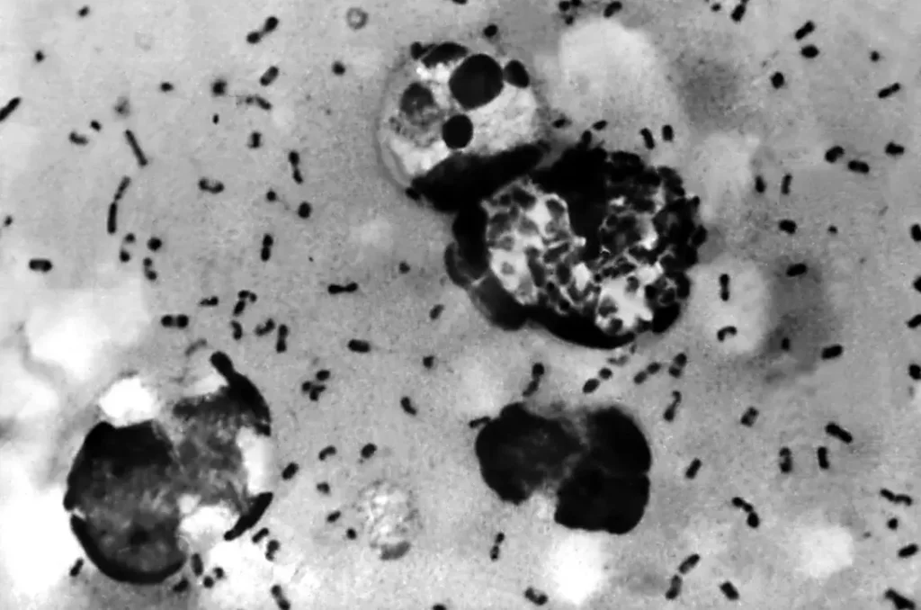 Photo of bubonic plague bacteria