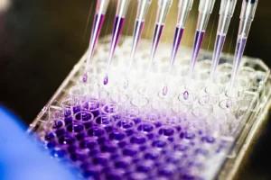 Northeastern research shows how gene edits could improve immunotherapy for solid tumor cancers and make treatments available “off-the-shelf.” Photo by Alyssa Stone/Northeastern University